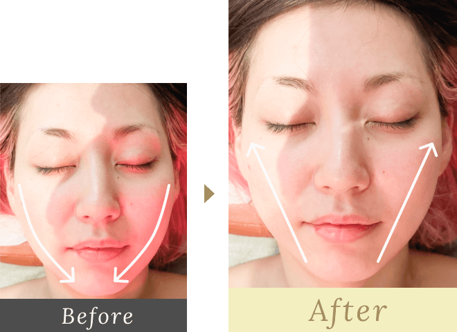 Before-After01