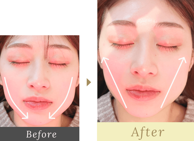 Before-After02