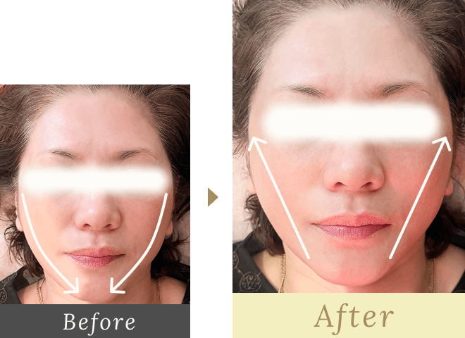 Before-After03