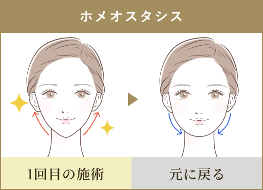 ホメオスタシス